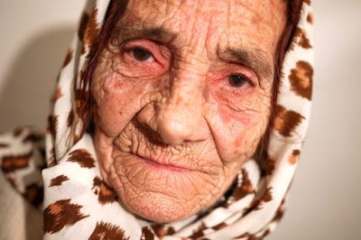 80-year-old spiritual healer cures blindness by licking patients' eyeballs